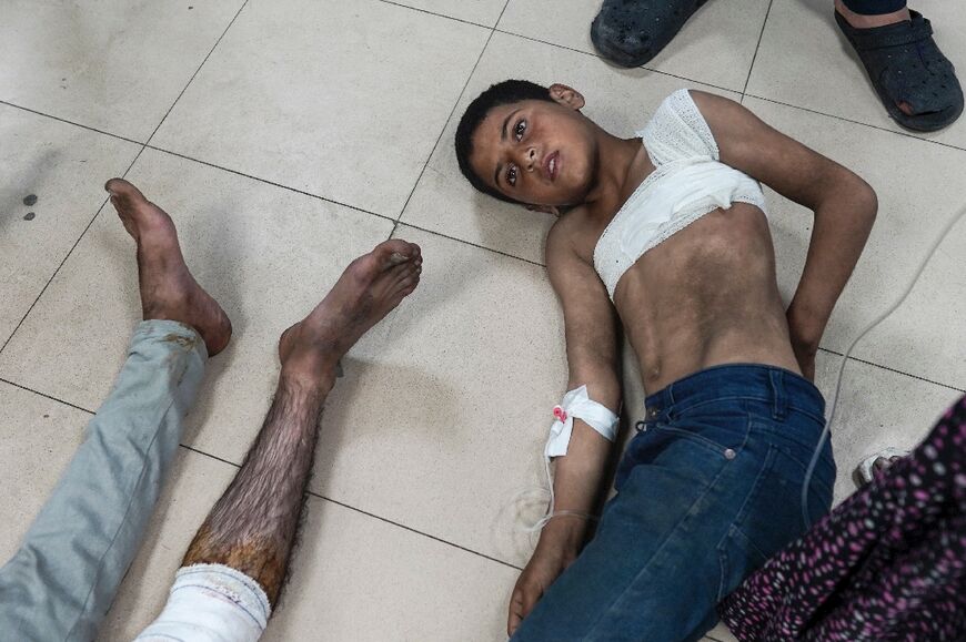 Injured Palestinians wait to receive treatment at hospital in Deir el-Balah -- the health ministry in Hamas-ruled Gaza says most of those killed in the war have been women and children
