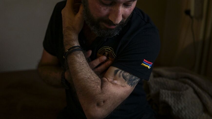 Despite his injuries, Davidyan said he was ready to take up arms again to recover Karabakh
