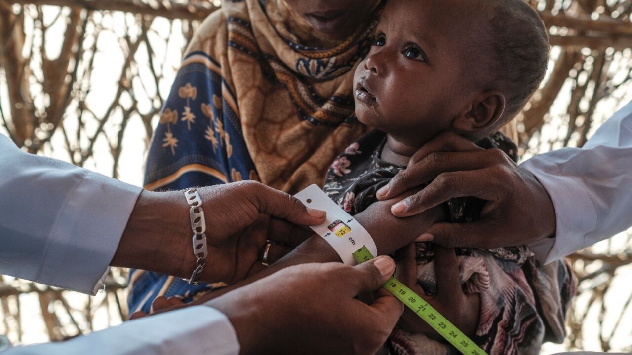 A health worker takes an arm measurement, a benchmark of malnutrition, at a Save the Children mobile clinic near Gode, Ethiopia