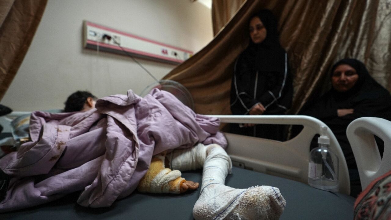 A Palestinian girl injured in Israeli bombardment in central Gaza receives care at the Al-Aqsa Martyrs hospital in Deir el-Balah