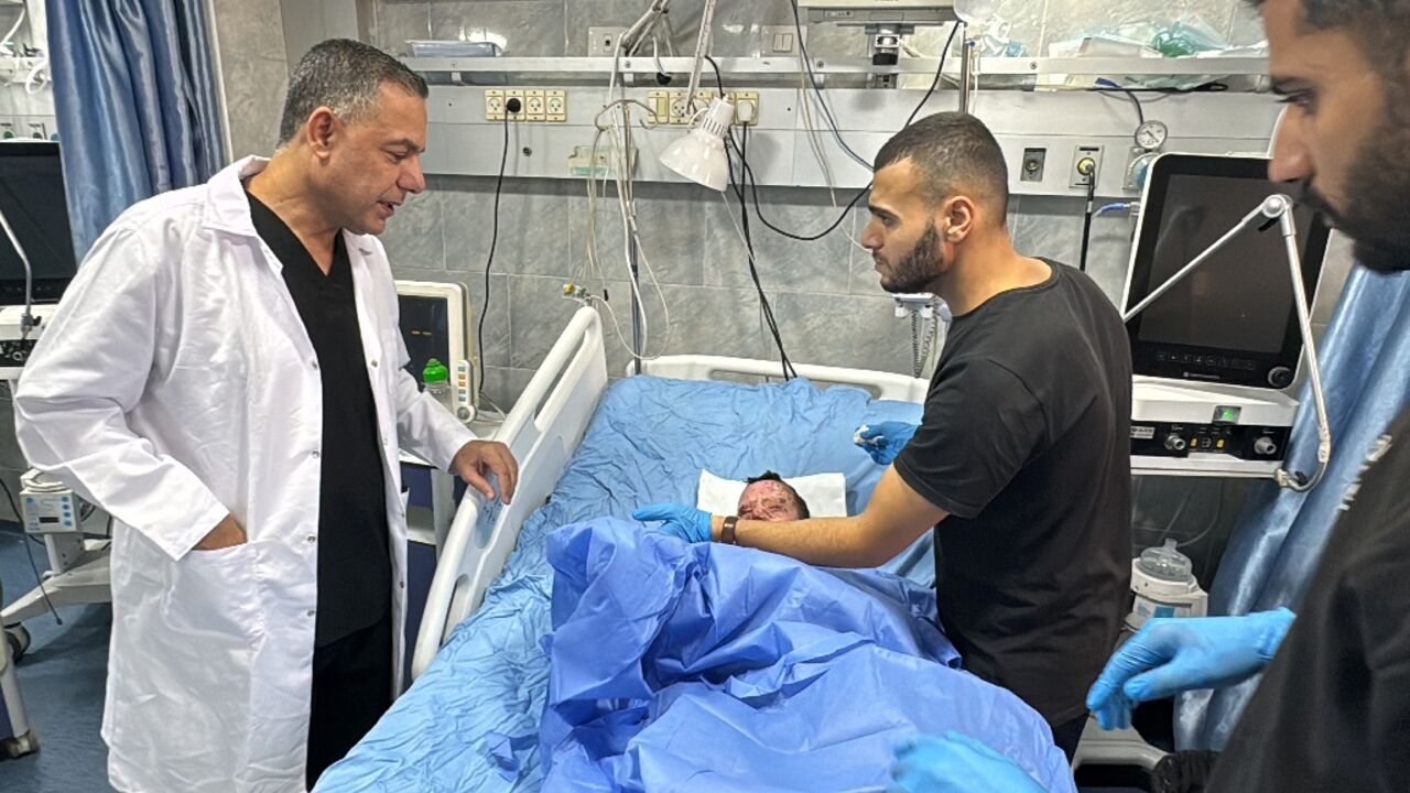 Kamal Adwan hospital chief, Hossam Abu Safiyeh, checking an injured child on October 24, 2024 amid the ongoing war in Gaza