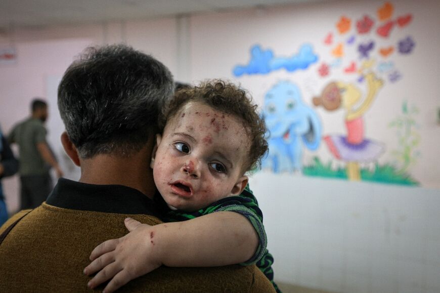A man holds a child wounded in a strike, at the al-Quds hospital on November 5, 2023