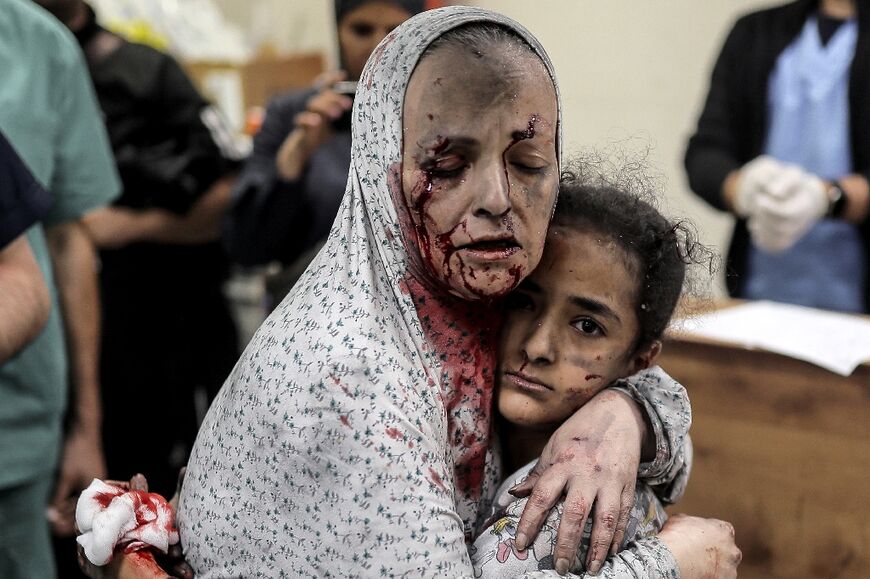 A wounded Palestinian woman hugs an injured girl child at Khan Yunis hospital in the southern Gaza Strip on November 15, 2023