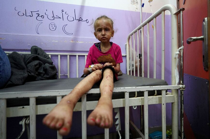 A Palestinian child waits for treatment at Al-Aqsa Martyrs Hospital in Deir al-Balah in the central Gaza Strip on May 30, 2024