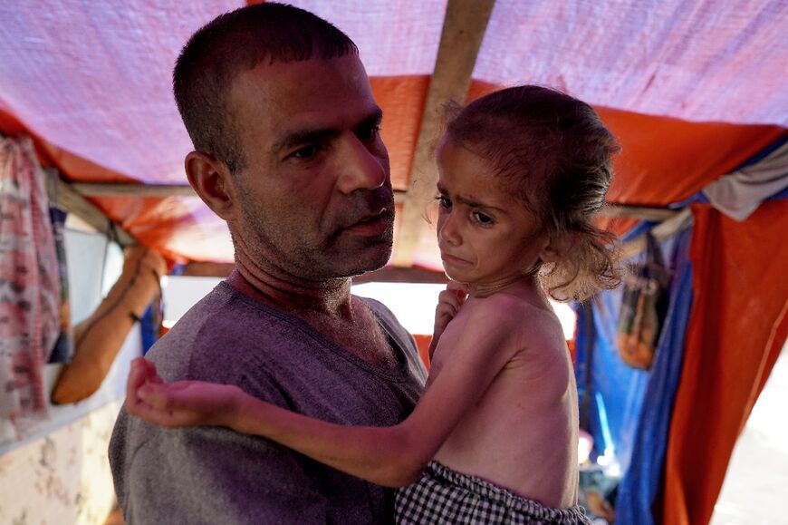 A four-year-old Gazan child suffering from malnutrition and displaced from Gaza City, is held in a tent in Zawayda in the central Gaza Strip on June 4, 2024