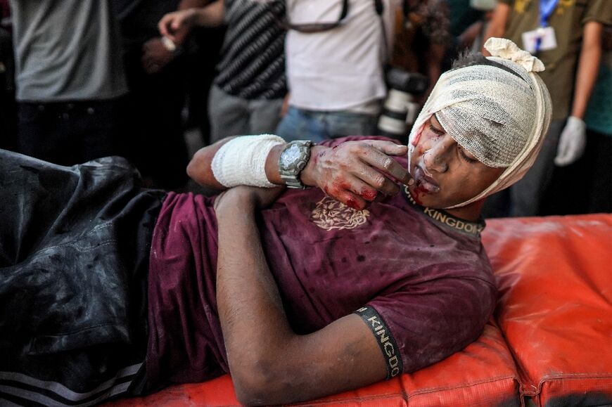 A youth wounded in an Israeli bombardment at Bureij is treated at the Al-Aqsa Martyrs hospital in central Gaza