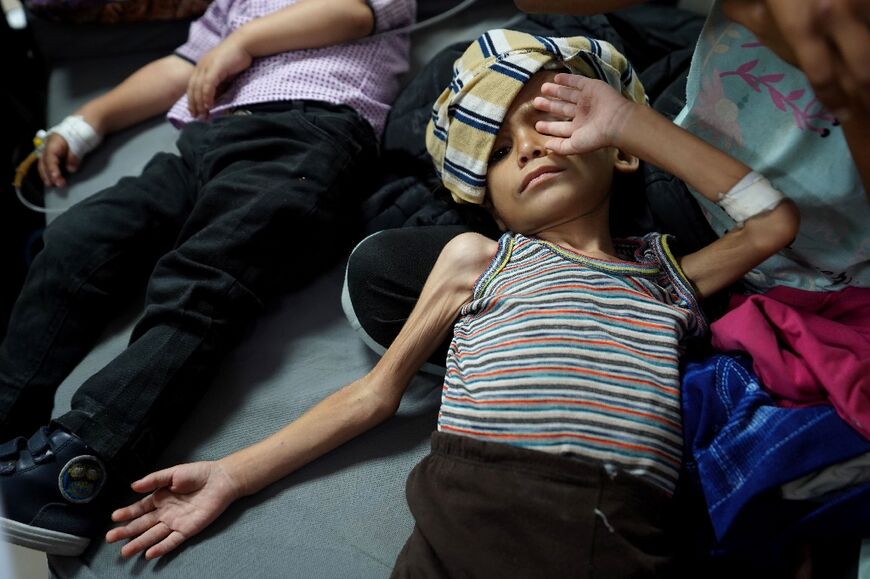 Palestinian children receive malnourishment treatment at Al-Aqsa Martyrs Hospital