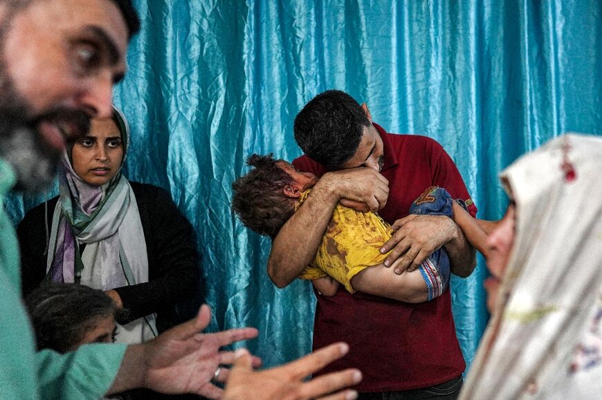 A man embraces an injured child following Israeli bombardment on al-Bureij, at a trauma ward at the Aqsa Martyrs hospital in Deir el-Balah in the central Gaza Strip on June 4, 2024 