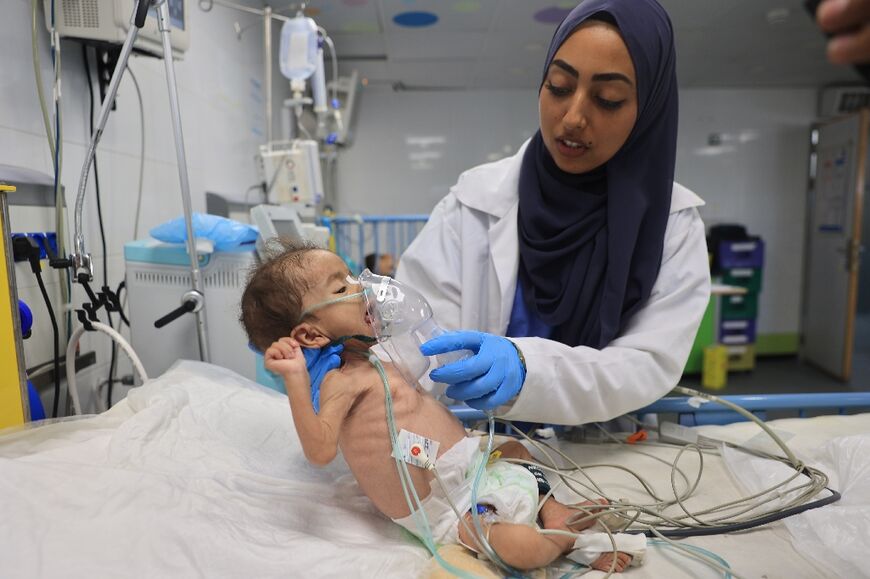 A malnourished Palestinian child is treated by a nurse at Nasser hospital in Khan Yunis city, central Gaza -- the UN has long warned of looming famine but one has not been officially declared