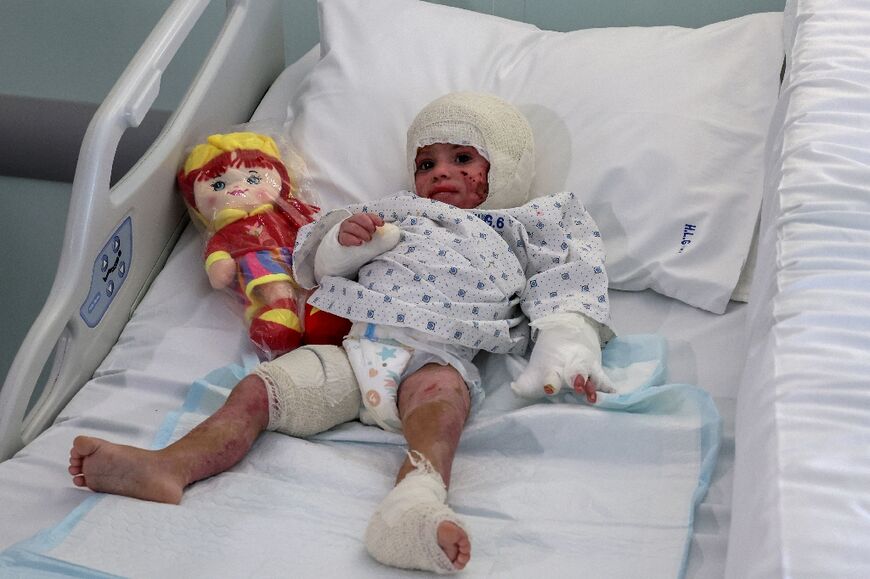 Ivana suffered third-degree burns in the Israeli strike in southern Lebanon