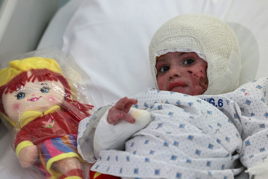 Two-year-old Ivana Skayki suffered burns in an Israeli strike in southern Lebanon