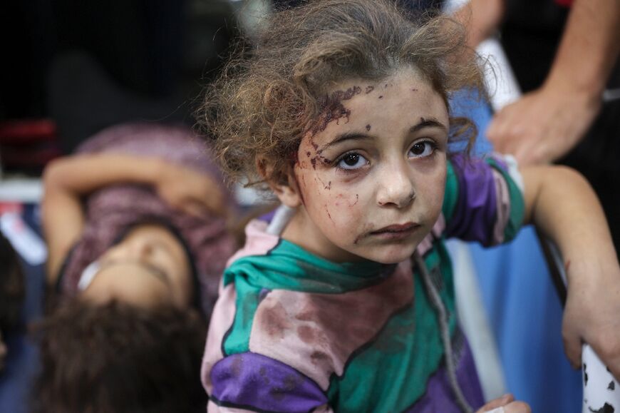 Injured children in the Jabalia refugee camp in the central Gaza Strip await treatment