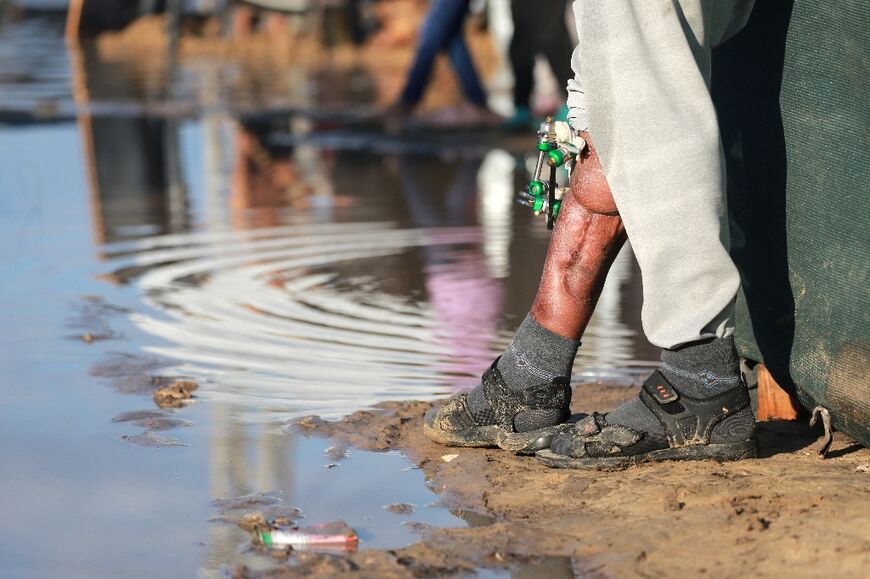 A wounded and displaced Palestinian stands next to a puddle of rain water at a makeshift camp in Khan Yunis, southern Gaza