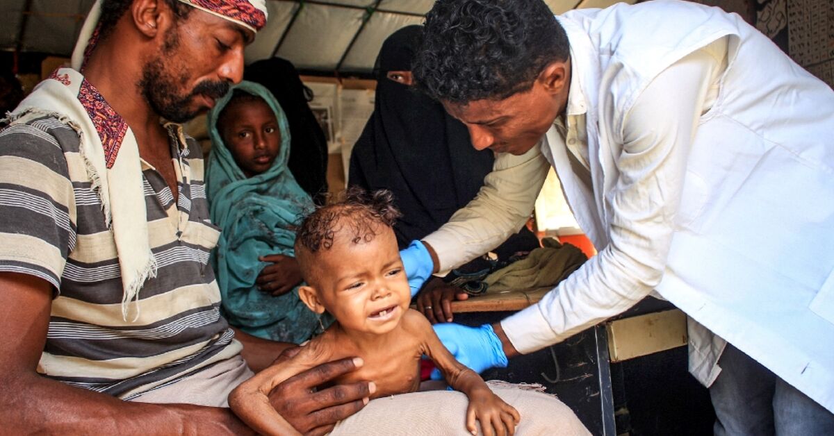 Famine situations in war-torn Yemen rising sharply: UN